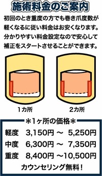 施術料金について
