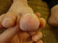 右足親指　R50　L60 左足親指 R70　L50