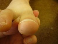 右足親指　Lサイド 左足親指 Rサイド　Lサイド