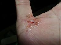 最近、よく怪我をする